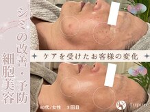 ルプレ(Lupure)の雰囲気(ハーブピーリング3回の施術で肌質改善◎低刺激なのに効果絶大◎)