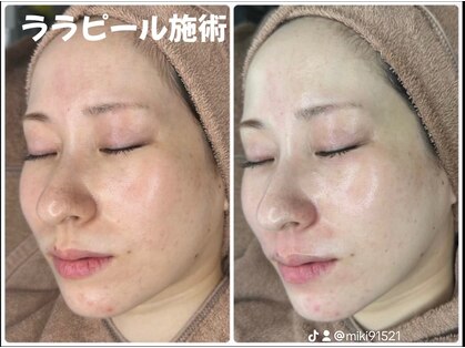 メルシー(merci)の写真