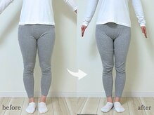 エーアール(AR)/【Before/After】3回目