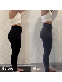 ジュノ(JUNO)の写真/【池袋5分★下半身特化】骨格診断×深層リメイク◎『整えてから動く』ので、健康的な縦長に伸びる美脚へ♪