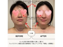 マリーズウィル(MARY's WILL)の雰囲気（施術2回で劇的変化！お顔の印象が変わる頭蓋骨小顔矯正★）