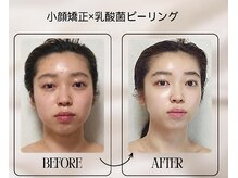 セレブリティ(Celebrity)の雰囲気(小顔も美肌も、一度に叶える 骨筋小顔矯正 乳酸菌ピーリング )