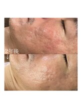 リュウ(le.lieu)/長年の肌荒れや赤みも、、、