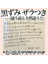 ルネッタ(Lunetta)/