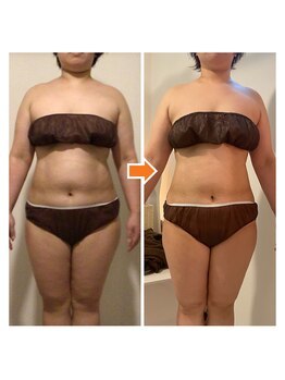 サルサナ(Salu Sana)/痩身！張り出したお腹もこの通り