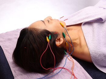 シー バイ カリスタ 新宿南口店(C by CALISTA)/1/fリズムで心地よい電気美容鍼