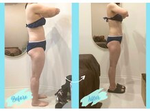 千歳の女神 三河安城店/【施術風景】Before/After