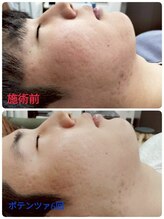 縁(en)/メンズ　ポテンツァ