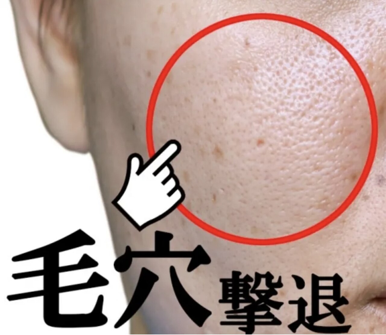 【まずはお試し集中】毛穴特化！(小鼻.頬)引き締めハーブピーリング☆\5,500