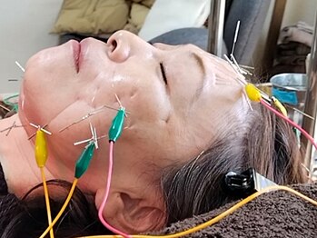 ひふねの写真/たるみ・シワは姿勢が原因？肩こり・猫背を整え、美容鍼の効果を最大化！顔と体の悩み、同時に解決！