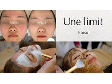 アンリミット 恵比寿店(Unelimit)