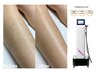 足の印象が変わる見せたくなる脚へひざ下集中ケア【ひざ下脱毛体験】