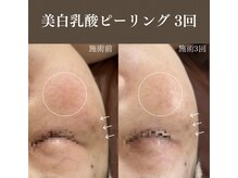 サロンドペシェ(salon de peche)/ざらつきOFF自然なツヤ肌に