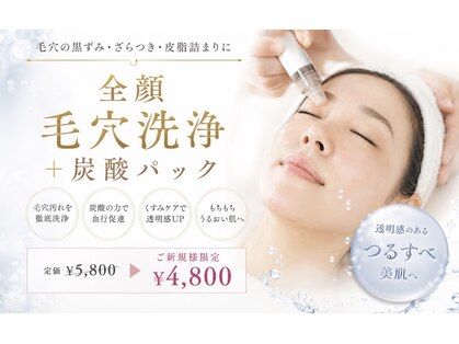 バニスター(Bannister)の写真