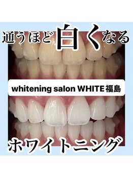 ホワイトニングサロン ホワイト(WHITE)/通うほど白くなる！