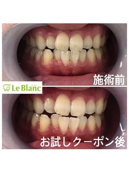 ルブラン 奈良店(Le Blanc)/ブライダルのお客様！