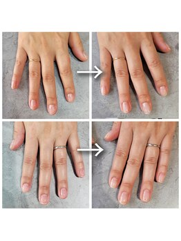 エヌ(enu.)/深爪ケア