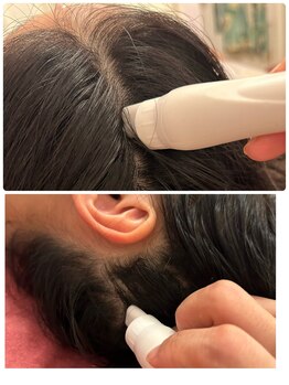 ティアラ(TIARA)/水素で毛穴洗浄 頭皮洗浄も可能