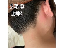 メルシートータルビューティー(MERCI)の雰囲気（うなじ脱毛メニューから選択してください。２２０0円）