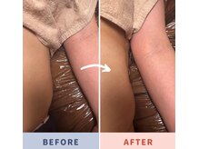 ☆NEW OPEN☆やみつき施術がとまらない！スッキリ爽快◎