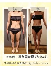 マルロ美容整体院 バイ サロンリーナ(MARLO美容整体院 by Salon Lena)/