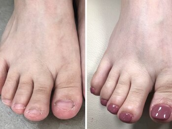 ネイルズシアムの写真/靴下で隠していた足も今年は自信を持ってサンダルを履ける足に！