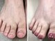 ネイルズシアムの写真/靴下で隠していた足も今年は自信を持ってサンダルを履ける足に！