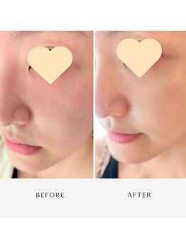 フィル 名駅店(fil)/肌育はfil名駅で♪