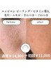 【エンビロン】【ニキビケア・毛穴・くすみ】　エンビロンピーリング70分岐阜