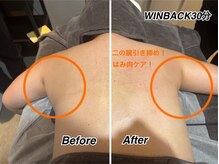 ザ ウィンバックサロン(THE WINBACK SALON)/巻き肩・二の腕のむくみケア