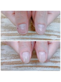 美爪育成補強クリア