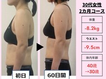 あすなろ鍼灸整骨院/ダイエット×痩身美容整体