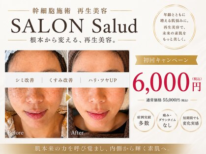 サロン サルー(SALON Salud)の写真