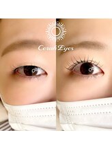 チュラアイズ(CerahEyes)/【お客様ビフォーアフター】