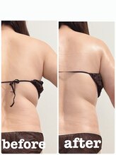 レヌール(LENULE)/リンパマッサージ