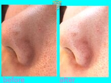 リュクス(LUXE)/ビフォーアフター