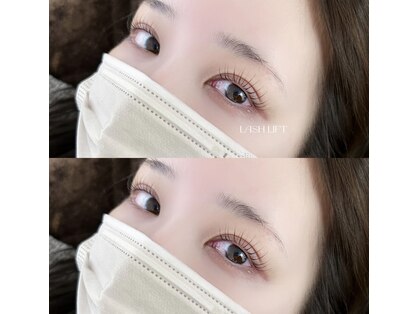 アニュ バイ リボーン(anu by Re born)の写真