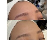 ブラジリアンワックス脱毛フェムケア 毛穴小顔美白専門 Salon de Noel 神戸三宮店の雰囲気(VIOブラジリアンワックス脱毛/顔脱毛/フェイシャル/フェムケア)