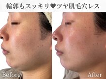 芯美 恵比寿店(shinbi)/クリスティーナ/オプティル