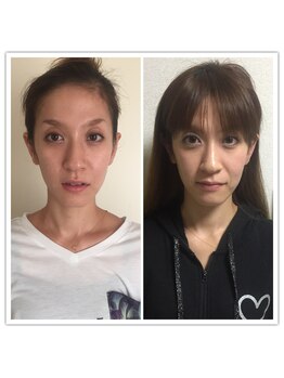 ラ アクサル(la.akthar)/小顔 全身 骨格矯正 整体