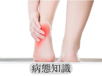 カワル整体 長嶺院/～足底筋膜炎～