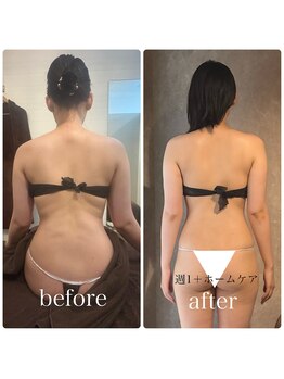 ブリス(BLiSS)/このみ式リンパ &nbsp;ブライダル