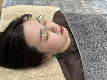 ユーフォリア(Euphoria)