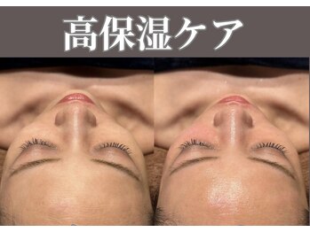 マヴィ 守口店(MavY.)/ジェルパックもっちりお肌へ！