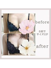 アリサナ(Arisana)/症例写真　バスト　葛西