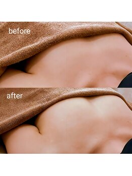 アンドボディ 横浜元町(&Body)/30代後半 バストアップ