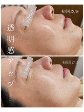 リブラン(Libran)/50代でノーファンデ♪