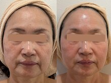 リボーン 柏(REBORN)の雰囲気（「自惚れ肌」か、「老け見え肌」か。見た目年齢の差、春で決まる）