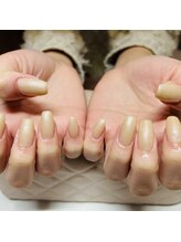 イーミリー(E.milii)/