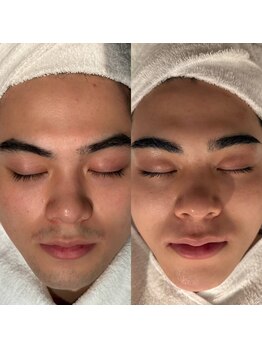 ル シェリア(Le Cherien)の写真/脱毛で結果を求めるなら当店にお任せ！メンズ脱毛でワンランク上の男に★濃くて太い毛もしっかり撲滅！